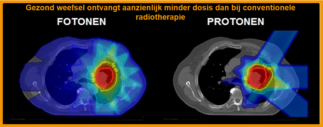 Protonensamenwerking